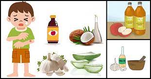 Getting Rid Of Ringworm The Natural Way Dr Farrah Md