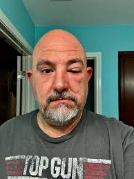 The Sting of Beekeeping — Gayne C. Young