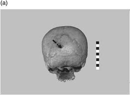Such camels have protective outer coats of coarse fibre that may grow as long as 15 inches (40 cm). Inhabitants Part Ii The Cambridge Companion To Ancient Athens