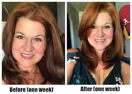 Best face forward with #1 selling anti-aging moisturizer -