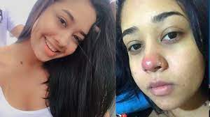 Perhatikan seksama aroma dan rasanya. Setelah Lakukan Tindik Hidung Wanita Ini Menderita Penyakit Yang Sangat Mengerikan Tribun Jambi