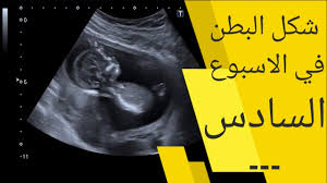 فأكثري من تناول اللحم والدجاج، بالإضافة إلى البقوليات (العدس، الفاصوليا، الفول) والخضار ذات الأوراق الخضراء (السبانخ والسلق). Ù†Ø¨Ø¶ Ø§Ù„Ø¬Ù†ÙŠÙ† ÙÙŠ Ø§Ù„Ø§Ø³Ø¨ÙˆØ¹ Ø§Ù„Ø³Ø§Ø¯Ø³ ÙŠÙˆØªÙŠÙˆØ¨