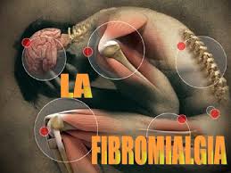 Resultado de imagen para masaje para aliviar fibromialgia