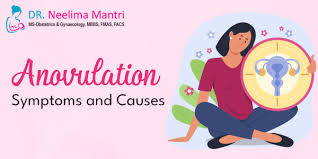 Image result for Anovulation