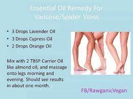 Essential Oil Remedy For Varicose Spider Veins Essential Oil Remedy Living Essentials Oils Varicose Vein Remedy