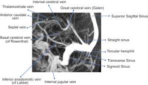 Plus your entire music library on all your devices. Superior Anastomotic Vein An Overview Sciencedirect Topics