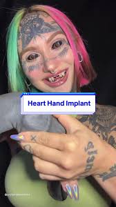 Body Mod Hand Implant