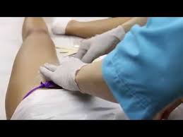 Brazilian laser hair removal facts and things to know before booking in for your treatment, including all your brazilian laser hair removal questions, answered. Brazilian Wax In Manhattan New York Brazilian Waxing Hair Removal For Women Nyc Youtube