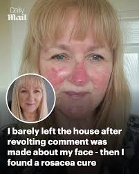 I bolted to the toilets and burst into tears' Read more:  https://trib.al/U0oVivG