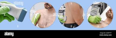 Image result for Probe-to-Bone Test