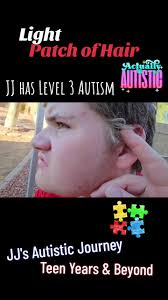 Did you notice the light patch of hair