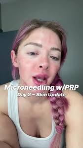 Miranda Cohen Muscle