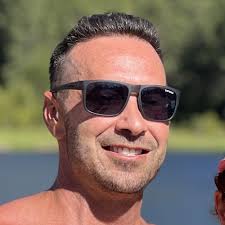 TOP 10 BEST Fue Hair Transplant in Carlsbad, CA