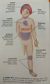 Pin By Caryln Little On Nclex Must Die Pediatric Nursing Nursing School Survival Rheumatic Fever