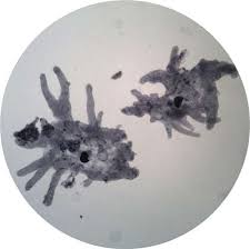 Naegleria fowler, also known as the brain eating amoeba, under a microscope. Protozoa Amoeba Proteus Prepared Slide School Science Equipment