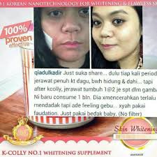 Required fields are marked *. K Colly Sweet 17 Collagen Instock Health Beauty On Carousell