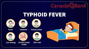 Image result for Typhoid Fever