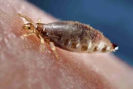 Heads with shorter hair tend to be colder, brighter and dryer which head lice think is unattractive. Can Pets Get Head Lice From Kids