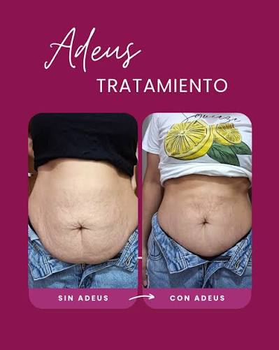 Decile ADEUS a las estrías! ✨ La nueva crema ADEUS está revolucionando el  cuidado corporal 💖 Su fórmula avanzada combina frutas tropicales, colágeno  y vitaminas naturales que: 🍑 Hidratan profundamente la piel