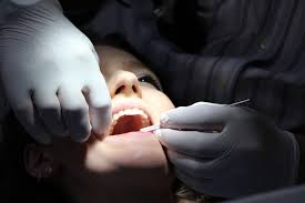 Certains crieront à la barbarie. Arracher Une Dent Ou Avulsion Extraction Dentaire