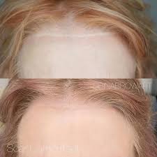 This isn't exactly the most clever way to cover up a tattoo, but we suppose it does the trick. Tattooing Over A Scar Everything You Need To Know Saved Tattoo