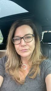 #funfact500 #seethedifference #advancingthescienceofdryeye #first25free…