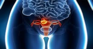 Rezultate imazhesh pÃ«r kanceri i mitres