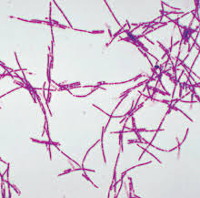 A new paper describes exactly how that happens and what needs to be done to prevent an anthrax spillover. News This Week Science