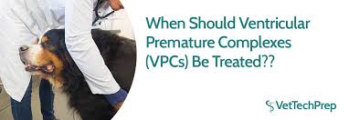 When Should Ventricular Premature Complexes Vpcs Be Treated