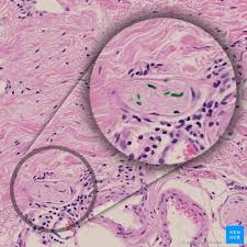Merkel cells are found in the epidermis (outer layer of the skin). Peripheral Nerves Histology And Clinical Aspects Kenhub