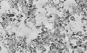 A number of techniques are used to prepare and observe chalk samples under a microscope. Diatomaceous Earth Wikiwand
