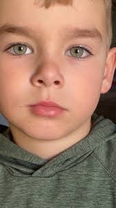 One of the babies wanted to be special, so he chose to have red eyes