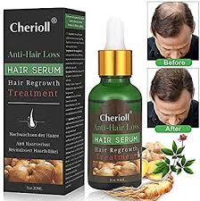 Amazon Com Suero Para El Crecimiento Del Cabello Perdida De Cabello Y Tratamiento De Adelgazamiento Del Cabello Suero P Hair Serum New Hair Growth Hair Loss