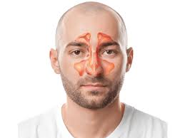 الجيوب الأنفية آفات تنفسية مزعجة صحيفة الخليج