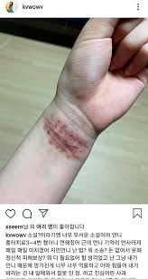 앞서 권민아는 3일 오후 자신의 인스타그램을 통해 한 멤버의 지속적인 괴롭힘이 있었다며 과거 일화와 함께 그룹 에이오에이 탈퇴 배경을 폭로했다. ê¶Œë¯¼ì•„ Aoaì§€ë¯¼ ê´´ë¡­íž˜ í­ë¡œ ì†ëª© í‰í„° ê³µê°œí•´