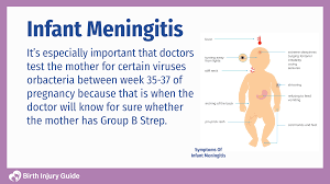 Compared with other forms of meningitis, bacterial meningitis is often more severe and life threatening. Infant Meningitis And Your Baby S Health Birth Injury Guide