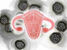 Hpv stands for human papillomavirus. Hp Virus Der Virus Uber Den Niemand Sprechen Mochte Frauenseiten Bremen