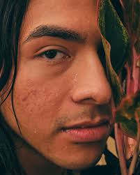 Landon Hale (@landonhale) · Instagram 照片和视频