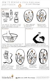 Image result for Ring Removal