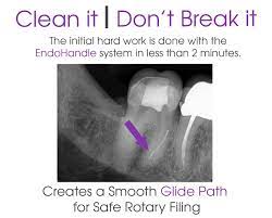 Endohandle Used In Endodontic Root Canal Glide Path Preparation Venta Endo Root Canal Canal Endodontist