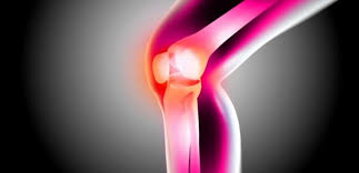 Kireclenme Osteoartrit Nedir Belirtileri Ve Tedavisi Hakkinda Bilgi