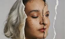 Why you should consider a career in occupational therapy