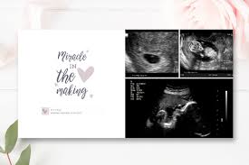 Baby studio album design template free download psd files. Baby Album Template Psd Photo Book Template Baby Photo Books Baby Album Design