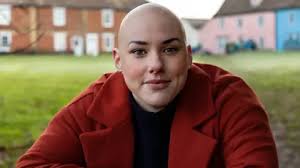 Alopecia: 'I'm ditching my wig in public after Oscars row'