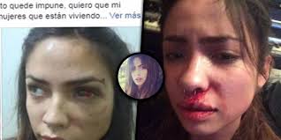 Sólo por vive de vtr. Novia Denuncia El Lado Desconocido De Un Famoso Rapero Sus Agresiones Eran Realmente Salvajes Para Los Curiosos