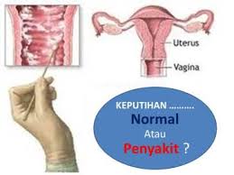 Bengkak dari lelaki, atau air mani dan sperma yang boleh keluar dari faraj selepas hubungan seksual. Gatal Di Kemaluan Seberat Zarah