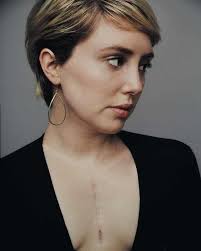 3 year anniversary since open heart surgery.