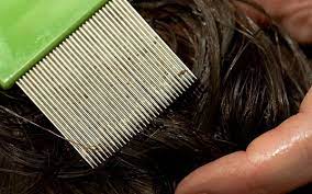 Check spelling or type a new query. How To Spot Head Lice And Nits Which