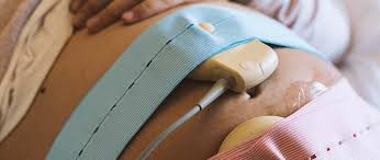 Image result for Non-Stress Test