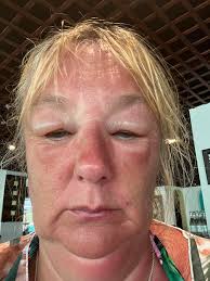 The following are regularly offered up as potential outcomes/consequences  of taking/failing to take certain actions and yet: I have never seen  anybody slip